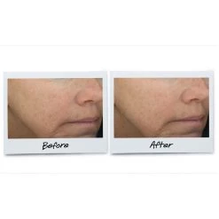 Kiehl's Powerful-Strength Line-Reducing Concentrate Siero -Negozio online Frank Provost || Kiehl's Italia Kiehl s Sieri Powerful Strength Line Reducing Concentrate 4